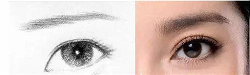 天津伊美尔王牌项目芭比美眼双眼皮，放大双眼魅力