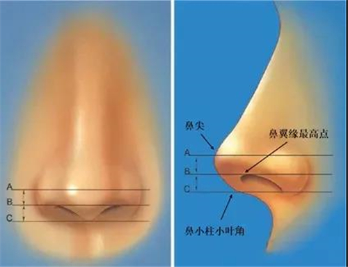 天津伊美尔招牌术式，仿生肋骨鼻塑造自然鼻部形态