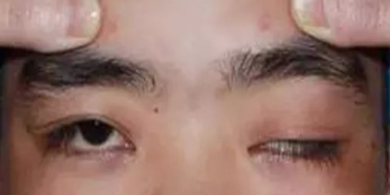云图片